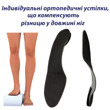 Індивідуальні ортопедичні...